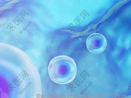 兰溪肾硬化干细胞治疗医院排行榜