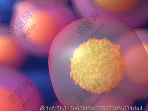 1型糖尿病可以用干细胞治疗吗多少钱