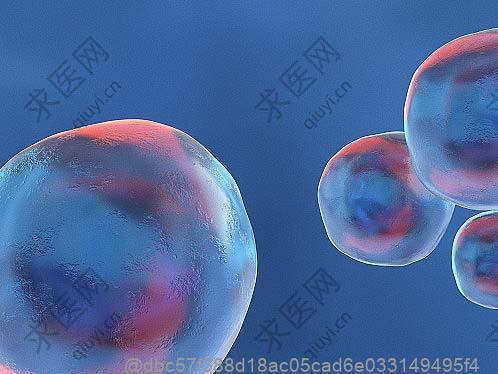 脑萎缩腿痛是怎么回事
