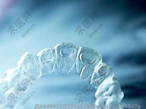 骨肿瘤标志物检查多少钱